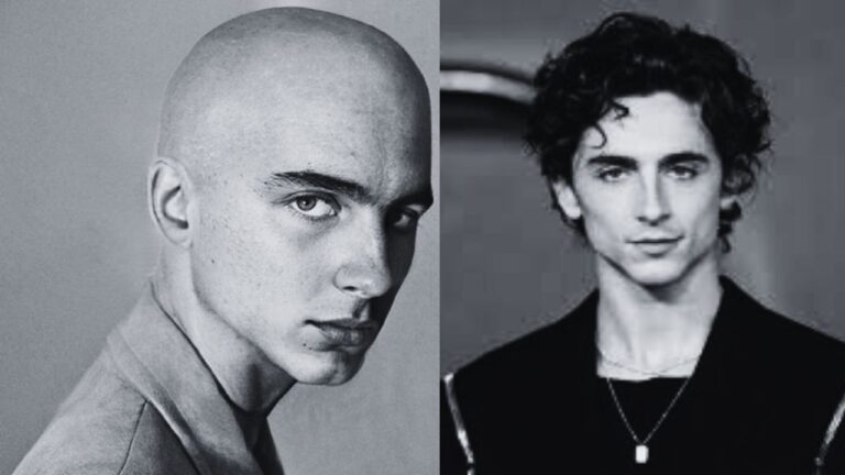 Timothee Chalamet Bald